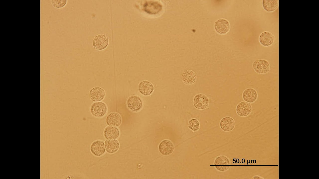 Leukocyten En Nitriet In Urine