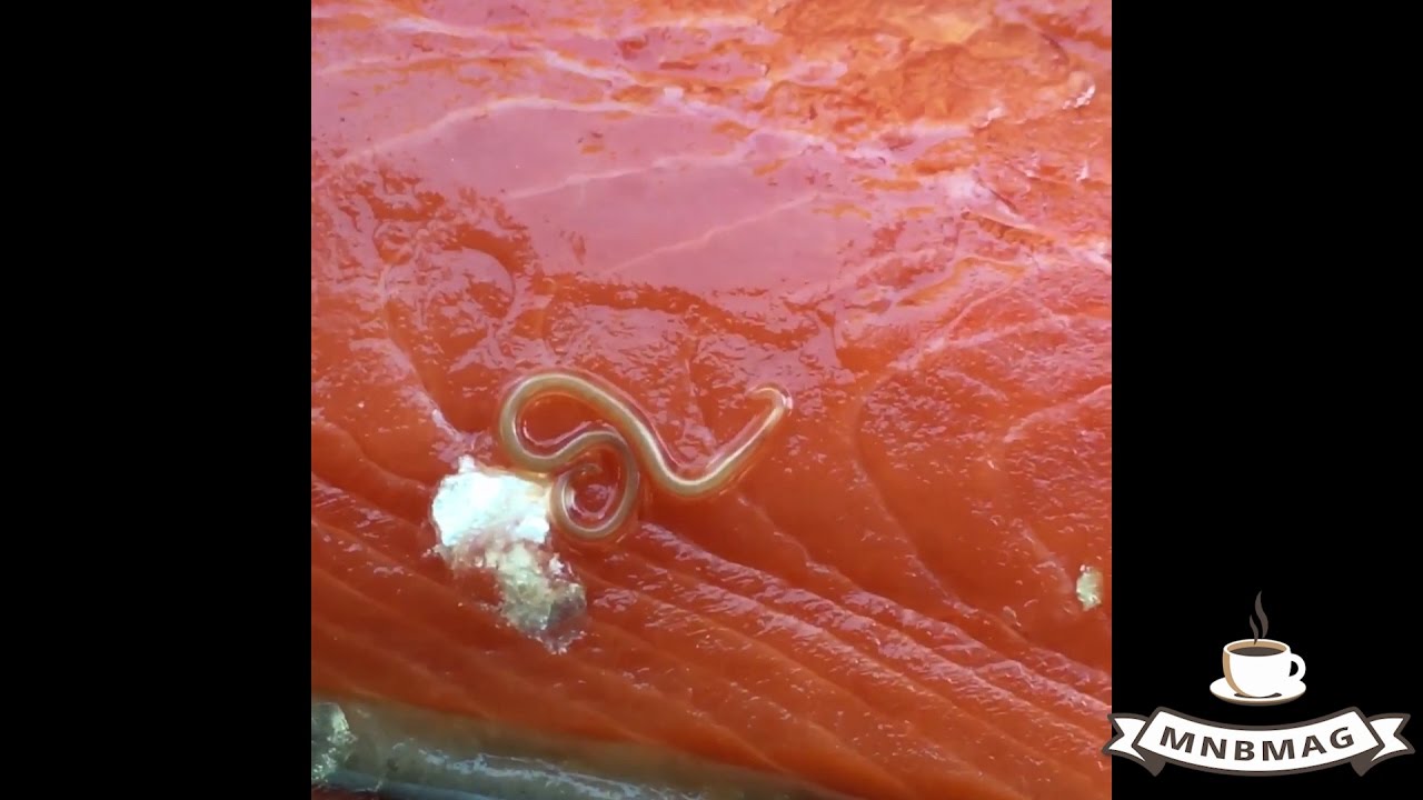 Wormen / Parasieten in Zalm - YouTube - Hoe Ziet Een Parasiet Eruit