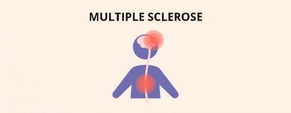 Ziekte: multiple sclerose (MS) - Isra bint Ali - Wat Is Ms Voor Ziekte